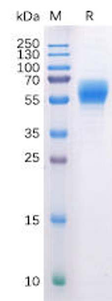 Human CB1 Recombinant Protein (hFc Tag) (HDPT0135)