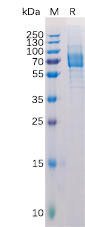 Human Galectin 9  Recombinant Protein (hFc Tag) (HDPT0147)