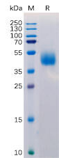 Human MICB Recombinant Protein (His Tag) (HDPT0148)