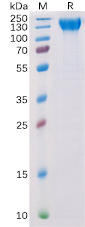 Human VEGFR2 Recombinant Protein (His Tag) (HDPT0152)