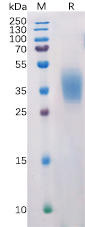 Human PDL2 Recombinant Protein (His Tag) (HDPT0155)