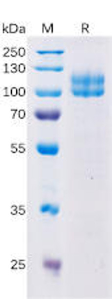 Human SLAMF3 Recombinant Protein (hFc Tag) (HDPT0163)