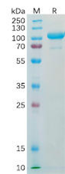 Human AFP Recombinant Protein (hFc Tag) (HDPT0165)