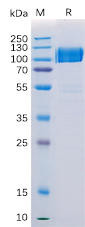 Human AXL Recombinant Protein (hFc Tag) (HDPT0179)