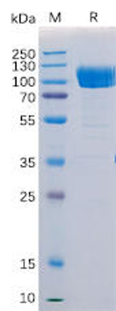 Human AXL  Recombinant Protein (mFc Tag) (HDPT0180)