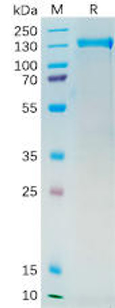 Human PSMA Recombinant Protein (mFc Tag) (HDPT0193)