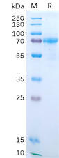 Human IL15RA Recombinant Protein (hFc Tag) (HDPT0195)