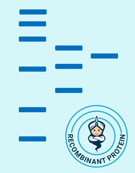 Human CXC-R3 Recombinant Protein (hFc Tag) (HDPT0233)