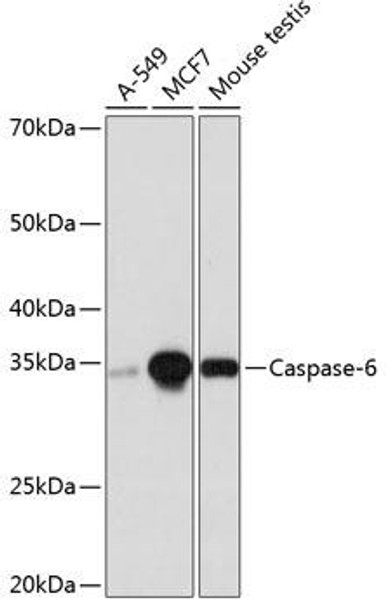 Anti-Caspase-6 Antibody (CAB19559)