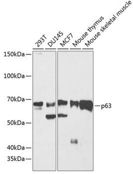 Anti-p63 Antibody (CAB19652)