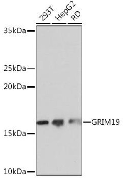 Anti-GRIM19 Antibody (CAB3782)