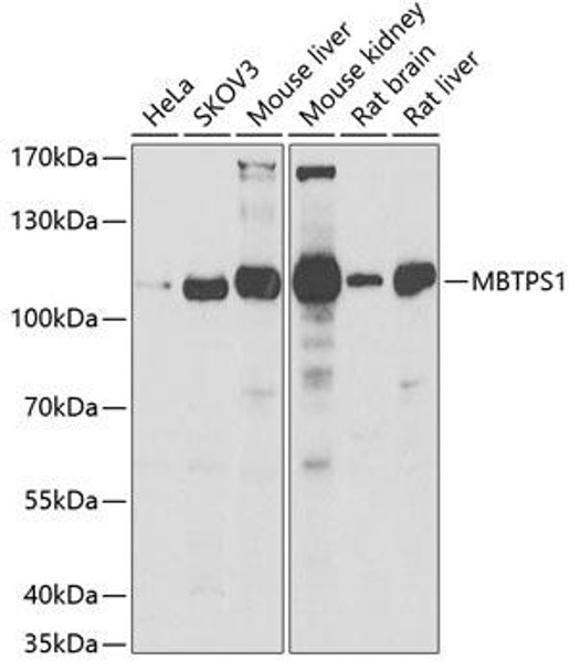 Anti-MBTPS1 Antibody (CAB7025)