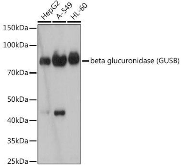 Anti-beta glucuronidase (GUSB) Antibody (CAB19248)