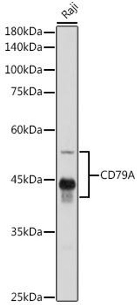 Anti-CD79A Antibody (CAB0331)