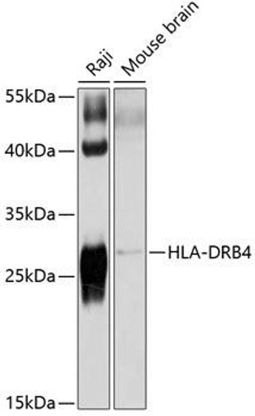 Anti-HLA-DRB4 Antibody (CAB10078)