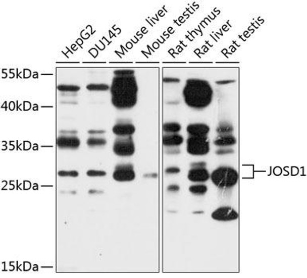 Anti-JOSD1 Antibody (CAB10426)