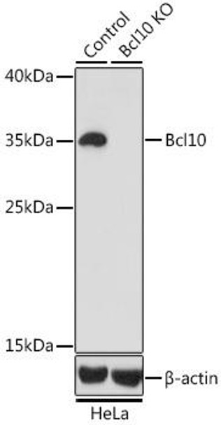 Anti-Bcl10 Antibody (CAB1106)[KO Validated]