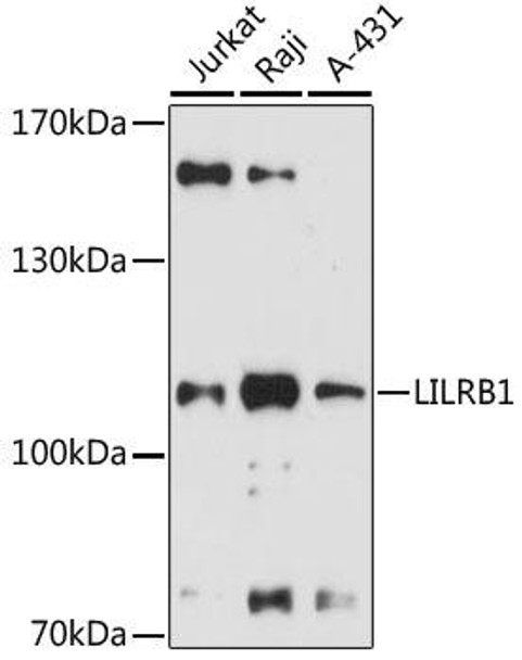Anti-LILRB1 Antibody (CAB12827)