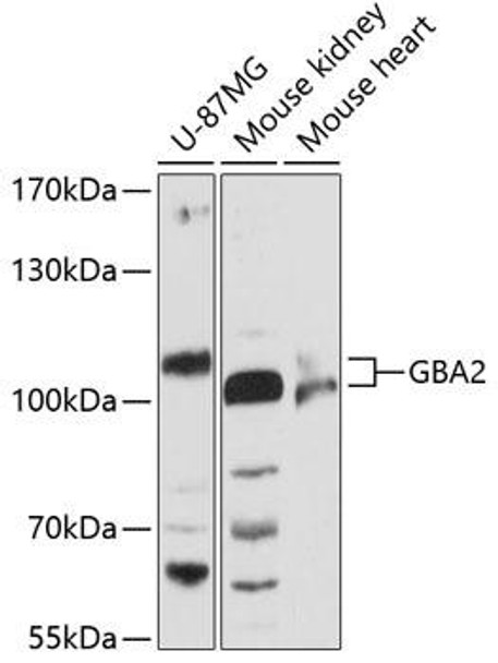 Anti-GBA2 Antibody (CAB12834)