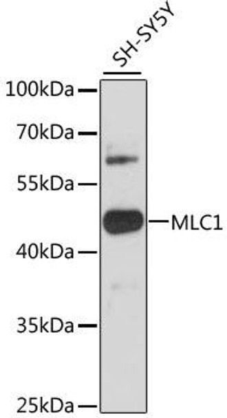 Anti-MLC1 Antibody (CAB12840)