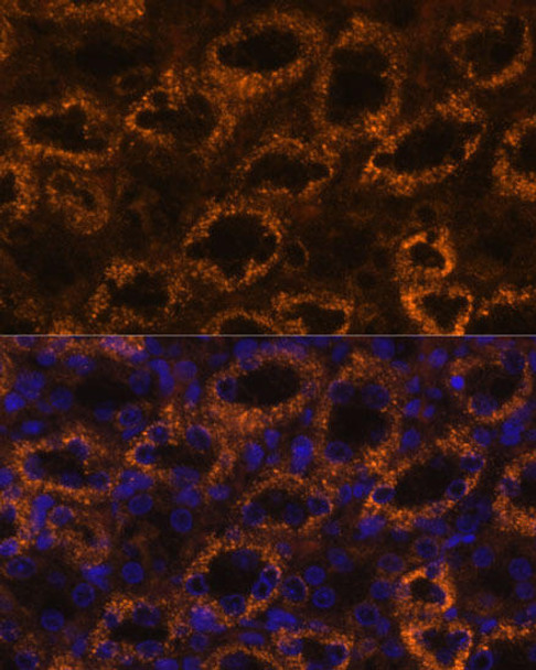 Anti-SLC7A9 Antibody (CAB12848)
