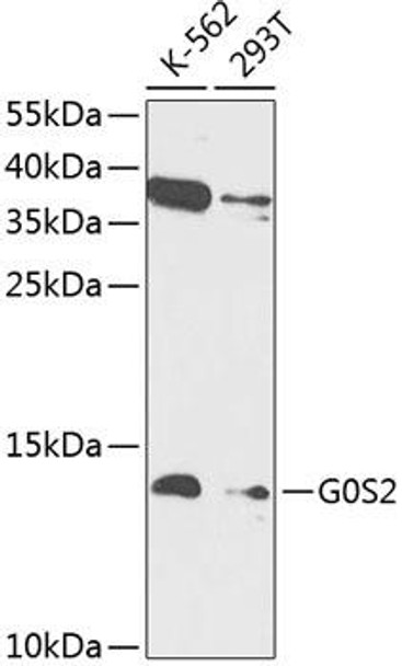 Anti-G0S2 Antibody (CAB14125)