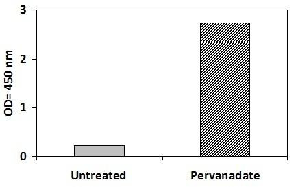 Human Phospho-Estrogen receptor (S118) PharmaGenie ELISA Kit (SBRS1813)
