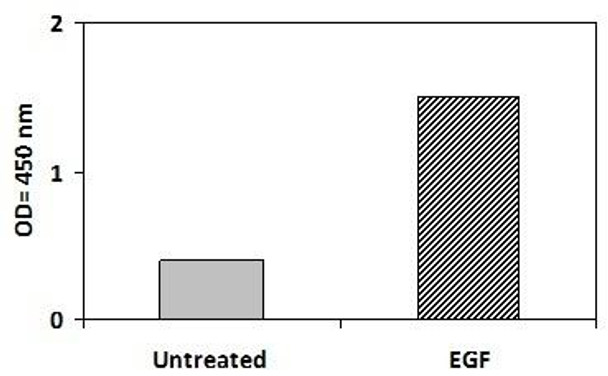 Human Phosphotyrosine Erb-B2 PharmaGenie ELISA Kit (SBRS1815)