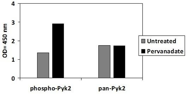 Human Phospho-PYK2 (Y402) and Total PYK2 PharmaGenie ELISA Kit (SBRS1942)