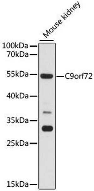 Anti-C9orf72 Antibody (CAB15970)