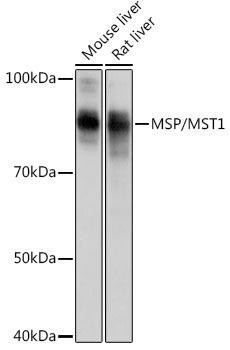 MSP/MST1 Rabbit Monoclonal Antibody (CAB0109)