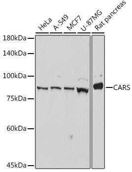 CARS Rabbit Monoclonal Antibody (CAB0438)