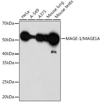MAGE-1/MAGE1A Rabbit Monoclonal Antibody (CAB0723)
