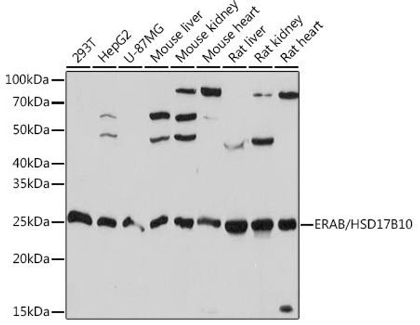 ERAB/HSD17B10 Rabbit Monoclonal Antibody (CAB0959)
