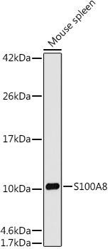 MRP8 Rabbit Monoclonal Antibody (CAB12018)