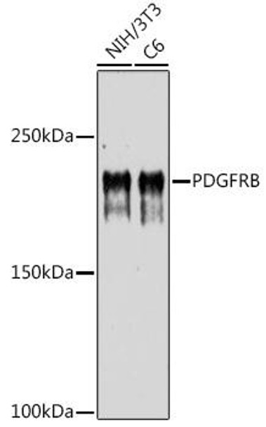 PDGFRB Rabbit Polyclonal Antibody (CAB1444)