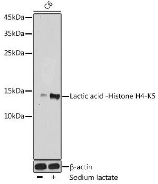 Lactic acid -Histone H4-K5 Rabbit Polyclonal Antibody (CAB18829)