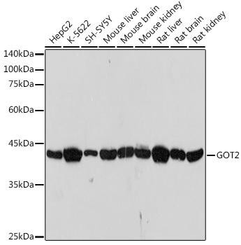 GOT2 Rabbit Monoclonal Antibody (CAB19245)