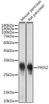 PRSS2 Rabbit Monoclonal Antibody (CAB19275)