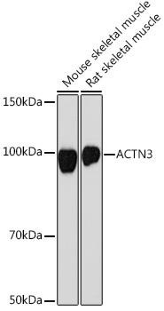 ACTN3 Rabbit Monoclonal Antibody (CAB19631)