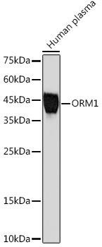ORM1 Rabbit Monoclonal Antibody (CAB19736)