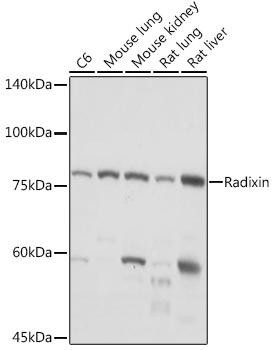 Radixin Rabbit Monoclonal Antibody (CAB19751)