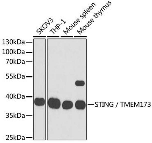Anti-STING / TMEM173 Antibody (CAB3575)