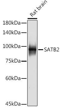 SATB2 Rabbit Monoclonal Antibody (CAB19837)