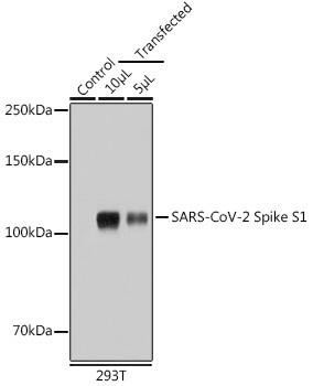 SARS-CoV-2 Spike S1 Rabbit Polyclonal Antibody (CAB20136)
