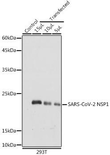 SARS-CoV-2 NSP1 Rabbit Polyclonal Antibody (CAB20200)