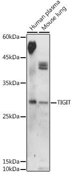 TIGIT Rabbit Polyclonal Antibody (CAB20350)