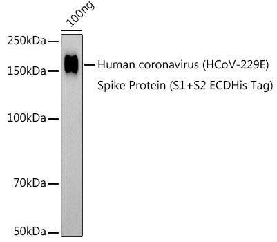HCoV-229E Spike S1 Rabbit Polyclonal Antibody (CAB20393)