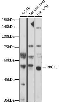 RBCK1 Rabbit Polyclonal Antibody (CAB20468)