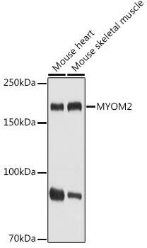 MYOM2 Rabbit Polyclonal Antibody (CAB20526)